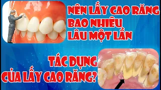 Nên lấy cao răng bao nhiêu lâu một lần và tác dụng của lấy cao răng là gì?