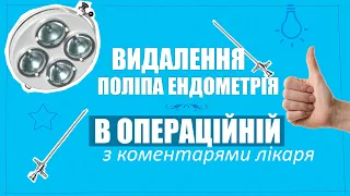 В операційній, з коментарями лікаря. Гістероскопія. Видалення поліпа ендометрія.