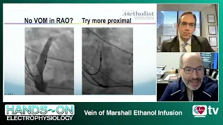 Hands-On Electrophysiology: Vein of Marshall Ethanol Infusion