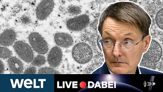 AFFENPOCKEN IN DEUTSCHLAND: Karl Lauterbach kündigt Eindämmungsmaßnahmen an | WELT Live dabei