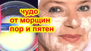 ЭТА маска БОМБА! Уберёт Даже ГЛУБОКИЕ МОРЩИНЫ ,поры , пятна ! рецепт