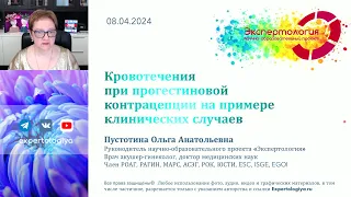 Кровотечения при прогестиновой контрацепции на примере клинических случаев l Пустотина О. А.