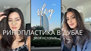 VLOG | Зачем я сделала ринопластику в Дубае? ШОКИРОВАНА результатом