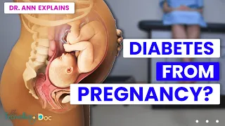 Managing Gestational Diabetes: Tips and Tricks for a Healthy Pregnancy | Doctor Explains