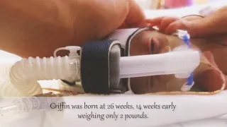 Baby born at 26 weeks