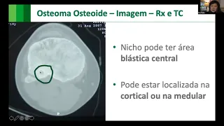 MÓDULO 01 - Oncologia Ortopédica