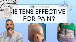 Does TENS Actually Work? | Expert Physio Review