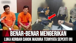 BEGINI KONDISI LUKA KORBAN CAROK MADURA MAT TANJAR VS HASAN