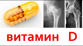 Витамин Д- лекарство от псориаза, сахарного диабета, остеопороза, рахита, атеросклероза