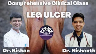 LEG ULCER Clinical case presentation