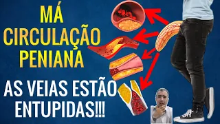 MÁ CIRCULAÇÃO PENIANA: como fica sua ereção?