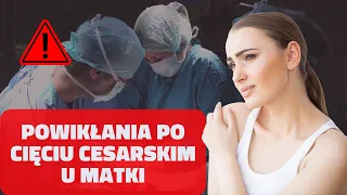 Powikłania po cięciu cesarskim u matki ⚠️