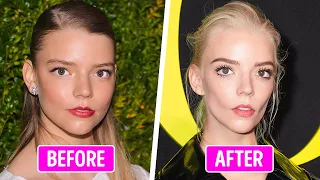 50+ Celebrities Whose Face Change Through the Time