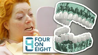 4 Bridges, 8 Dental Implants, 1 New Smile!