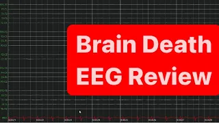 Brain Death EEG Review