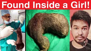 Crazy Things Found Inside Human Body | Tamil | Madan Gowri | MG