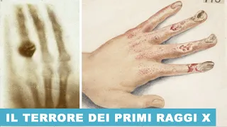 Il Terrore "esistenziale" della prima immagine a Raggi X