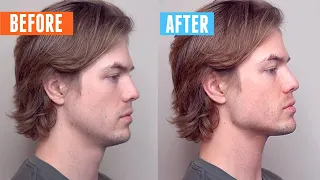 How to Fix Your "Ugly" Side Profile in 2 SECONDS!