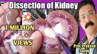 Dissection of Kidney - By Prof. Prakash Surve ( Moderator )