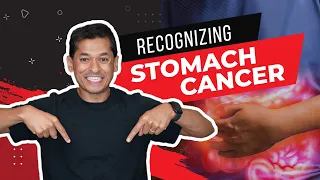 How Do You Know If You Have Stomach Cancer?