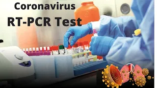 Coronavirus real time RT PCR Test   Simplified Mechanism