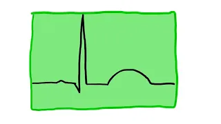 Po mojemu: EKG cz. 3