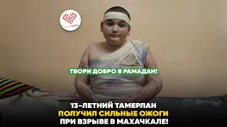 13-летний мальчик получил сильные ожоги после взрыва в Махачкале!