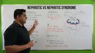 nephrotic vs nephritic syndrome in hindi || Kidney disease || kidney pathology || Nephrotic syndrome