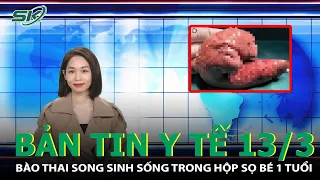 Bản Tin Y Tế 13/3: Phát Hiện Bào Thai Song Sinh Sống Trong Hộp Sọ Bé 1 Tuổi | SKĐS