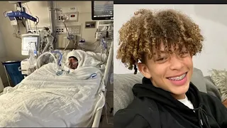 Mason Dark, 16, suffered third-degree burns after attempting a TikTok trend