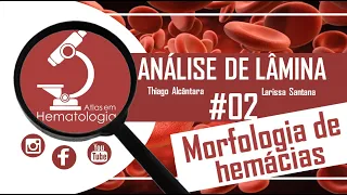 Análise de lâmina #02-Morfologia de hemácias