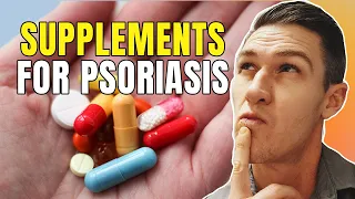 What Supplements Should You Take for Psoriasis? | How to Treat Psoriasis