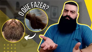 NÓ NA BARBA: o que é e como evita? 5 Dicas Para Acabar Com Este Problema!