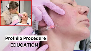 Profhilo Procedure and Correct Injection Technique (2024)