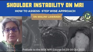 SHOULDER INSTABILITY - How To assess - a step wise approach || DR MALINI LAWANDE | bankart | slap