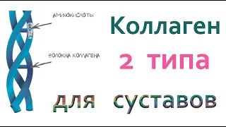 Для чего надо пить коллаген 2 типа? Останови артроз, остеохондроз