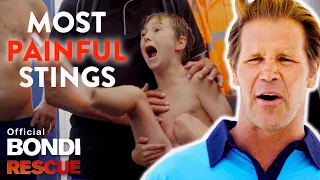 Worst Blue Bottle Jellyfish Stings on Bondi Rescue