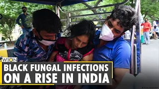 COVID-19: Black fungal infections on a rise in India