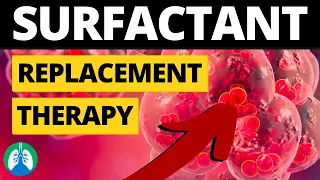 Surfactant Replacement Therapy (Medical Definition) | Quick Explainer Video