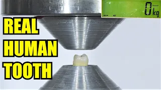 How Strong are Teeth? Hydraulic Press Test!