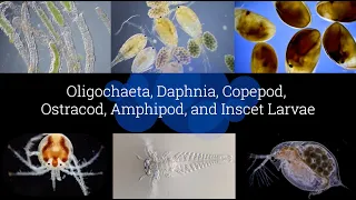 Microscopic Organisms in a Drop of Pond Water - Episode 4