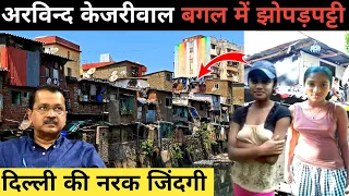 दिल्ली की झोपड़पट्टी की जिंदगी||Slum Area in Delhi||Slum Area Life||Dehli Local Life