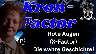 Kron-Factor: Rote Augen (X-Factor) - Die wahre Geschichte