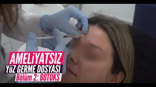 Ameliyatsız Yüz Germe Dosyasının 2. Bölümü: Botoks