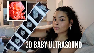 WHAT DOES BABY LOOK LIKE AT 31 WEEKS PREGNANT?! 3D Baby Ultrasound