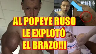 AL POPEYE RUSO LE EXPLOTÓ un BRAZO en PLENA PELEA!!!