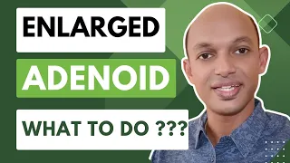 Adenoid problems in children | Latest treatment without surgery | #DrSandeep #Pediatrician