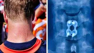 10 Injuries That Changed The NFL History Books FOREVER...