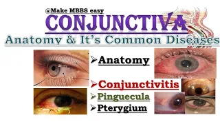 Anatomy of CONJUNCTIVA | Conjunctivitis, Types | Common Diseases | Ophthalmology | Make MBBS easy