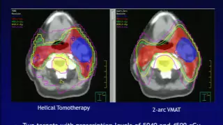 Medical Physics Estimation of Uncertainty due to MLC